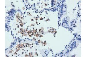 Immunohistochemistry (IHC) image for anti-rho GTPase Activating Protein 25 (ARHGAP25) antibody (ABIN1496701) (ARHGAP25 Antikörper)