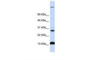Image no. 1 for anti-Chromosome 19 Open Reading Frame 56 (C19orf56) (N-Term) antibody (ABIN6738316)