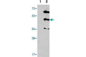 Western blot analysis of MAPK12 (arrow) using MAPK12 polyclonal antibody . (MAPK12 Antikörper  (Internal Region))