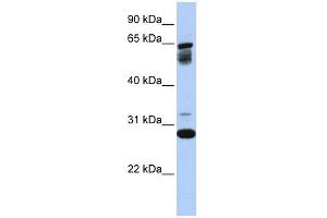 TMEM187 antibody used at 1 ug/ml to detect target protein.