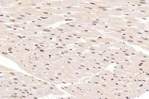 Immunohistochemistry analysis of paraffin-embedded rat heart using,ZBTB20 (ABIN7076248) at dilution of 1: 12000 (ZBTB20 Antikörper)