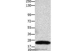 Western blot analysis of Human colon cancer tissue, using CLDN3 Polyclonal Antibody at dilution of 1:550 (Claudin 3 Antikörper)