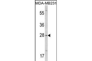 Western blot analysis of COLEC11 Antibody (N-term) (ABIN390822 and ABIN2841053) in MDA-M cell line lysates (35 μg/lane).