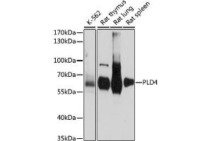 Western blot analysis of extracts of various cell lines, using PLD4 antibody (ABIN7269353) at 1:1000 dilution. (Phospholipase D4 Antikörper  (AA 52-200))