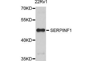 Western blot analysis of extract of 22Rv1 cells, using SERPINF1 antibody. (PEDF Antikörper)