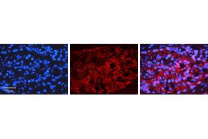 Rabbit Anti-NFKBIB Antibody   Formalin Fixed Paraffin Embedded Tissue: Human Testis Tissue Observed Staining: Nucleus, Cytoplasm Primary Antibody Concentration: 1:100 Other Working Concentrations: N/A Secondary Antibody: Donkey anti-Rabbit-Cy3 Secondary Antibody Concentration: 1:200 Magnification: 20X Exposure Time: 0. (NFKBIB Antikörper  (Middle Region))
