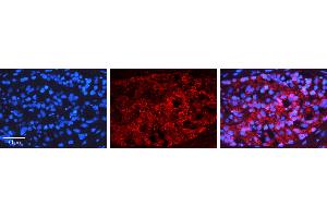 Rabbit Anti-NFKBIB Antibody   Formalin Fixed Paraffin Embedded Tissue: Human Testis Tissue Observed Staining: Nucleus, Cytoplasm Primary Antibody Concentration: 1:100 Other Working Concentrations: N/A Secondary Antibody: Donkey anti-Rabbit-Cy3 Secondary Antibody Concentration: 1:200 Magnification: 20X Exposure Time: 0.