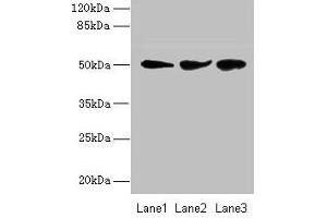 Western blot All lanes: NIM1K antibody at 2 μg/mL Lane 1: Jurkat whole cell lysate Lane 2: HepG2 whole cell lysate Lane 3: COLO205 whole cell lysate Secondary Goat polyclonal to rabbit IgG at 1/10000 dilution Predicted band size: 50 kDa Observed band size: 50 kDa (NIM1 Antikörper  (AA 1-436))