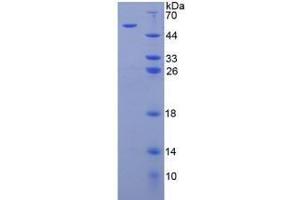 Image no. 1 for Arylsulfatase B (ARSB) (AA 81-533) (Active) protein (His tag) (ABIN6239887) (Arylsulfatase B Protein (ARSB) (AA 81-533) (His tag))