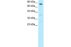 WB Suggested Anti-FOXE3 Antibody Titration:  0.