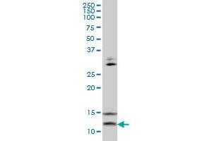 VAMP1 monoclonal antibody (M02), clone 5A4 Western Blot analysis of VAMP1 expression in HepG2 . (VAMP1 Antikörper  (AA 28-96))