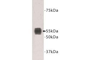 Western Blotting (WB) image for anti-Transmembrane Protein 132A (TMEM132A) antibody (ABIN1854988) (TMEM132A Antikörper)