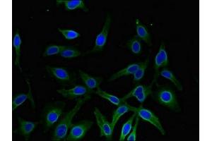 Immunofluorescent analysis of Hela cells using ABIN7143637 at dilution of 1:100 and Alexa Fluor 488-congugated AffiniPure Goat Anti-Rabbit IgG(H+L) (AKR1A1 Antikörper  (AA 2-325))