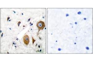 Immunohistochemistry analysis of paraffin-embedded human brain tissue, using mGluR8 Antibody. (GRM8 Antikörper  (AA 841-890))