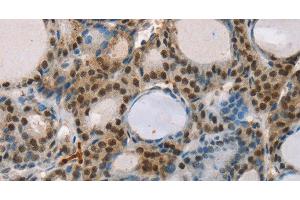 Immunohistochemistry (Paraffin-embedded Sections) (IHC (p)) image for anti-Runt-Related Transcription Factor 1, Translocated To, 1 (Cyclin D-Related) (RUNX1T1) antibody (ABIN7001483)