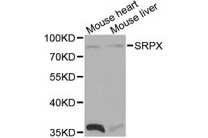 Western blot analysis of extracts of various cell lines, using SRPX antibody. (SRPX Antikörper)