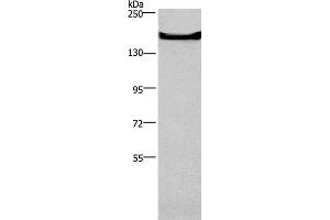 Western Blot analysis of Mouse bladder tissue using GPR124 Polyclonal Antibody at dilution of 1:300 (GPR124 Antikörper)