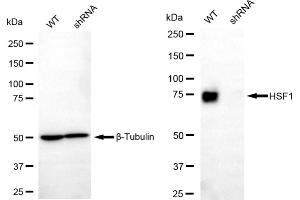Western blotting analysis using HSF1 antibody (ABIN7798862).