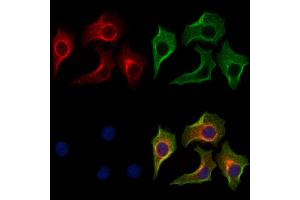 ABIN7094249 and ABIN7098296 staining HepG2 cells by IF/ICC. (GAMT Antikörper  (Internal Region))