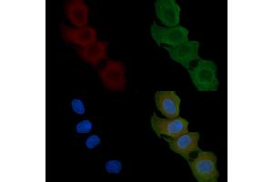 ABIN6258872 and ABIN6274907 staining Hela cells(45 min of heat-shock) by IF/ICC. (LFNG Antikörper  (Internal Region))