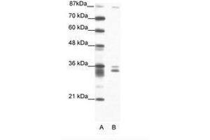 Image no. 1 for anti-PBX/knotted 1 Homeobox 2 (PKNOX2) (N-Term) antibody (ABIN202209)