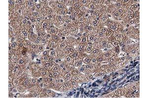 Immunohistochemical staining of paraffin-embedded Human liver tissue using anti-ACOT12 mouse monoclonal antibody. (ACOT12 Antikörper)