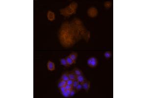Immunofluorescence analysis of MCF7 cells using SOCS1 Rabbit mAb (ABIN7270640) at dilution of 1:100 (40x lens). (SOCS1 Antikörper)