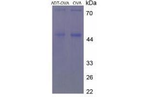 Image no. 2 for Androsterone (ADT) protein (Ovalbumin) (ABIN1880168) (Androsterone (ADT) protein (Ovalbumin))