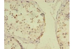 Immunohistochemistry of paraffin-embedded human testis tissue using ABIN7168313 at dilution of 1:100 (RBMY1F Antikörper  (AA 1-496))