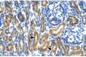 Rabbit Anti-HCLS1 Antibody ,Paraffin Embedded Tissue: Human Kidney  Cellular Data: Epithelial cells of renal tubule  Antibody Concentration: 4.