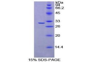 SDS-PAGE analysis of Rat Ribonuclease Inhibitor Protein. (RNH1 Protein)