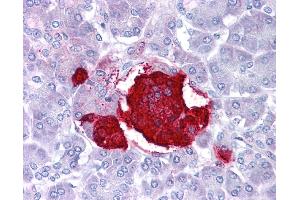 Leptin antibody was used for immunohistochemistry at a concentration of 4-8 ug/ml. (Leptin Antikörper  (Middle Region))