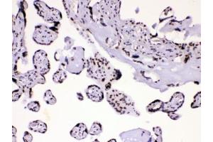 IHC testing of human placental tissue with hnRNP A1 antibody at 1ug/ml.