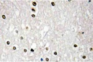 Immunohistochemistry (IHC) analyzes of p73 antibody in paraffin-embedded human brain tissue. (Tumor Protein p73 Antikörper)