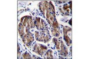 Immunohistochemistry analysis in Formalin Fixed, Paraffin Embedded Human stomach tissue using RPS4Y1 Antibody (Center) followed by peroxidase conjugation of the secondary antibody and DAB staining. (RPS4Y1 Antikörper  (Middle Region))