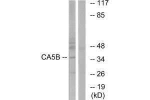 Western Blotting (WB) image for anti-Carbonic Anhydrase VB, Mitochondrial (CA5B) (C-Term) antibody (ABIN1851011) (CA5B Antikörper  (C-Term))
