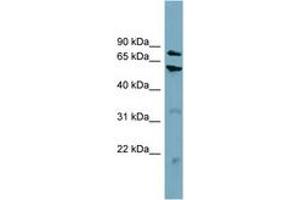 Image no. 1 for anti-Carnitine Palmitoyltransferase 1B (Muscle) (CPT1B) (AA 359-408) antibody (ABIN6743419) (CPT1B Antikörper  (AA 359-408))