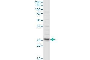 CLTA MaxPab rabbit polyclonal antibody. (CLTA Antikörper  (AA 1-218))
