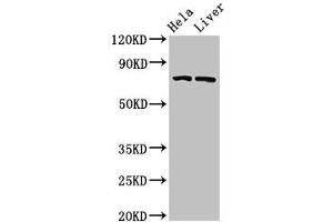 Western Blot Positive WB detected in: Hela whole cell lysate, Rat liver tissue All lanes: ACSL5 antibody at 3 μg/mL Secondary Goat polyclonal to rabbit IgG at 1/50000 dilution Predicted band size: 76, 83, 74, kDa Observed band size: 76 kDa (ACSL5 Antikörper  (AA 33-683))