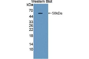 Detection of Recombinant THBS3, Human using Polyclonal Antibody to Thrombospondin 3 (THBS3)