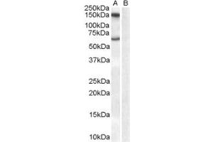 Western Blotting (WB) image for anti-Monoamine Oxidase B (MAOB) (Internal Region) antibody (ABIN2465923) (Monoamine Oxidase B Antikörper  (Internal Region))