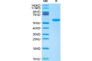 Mouse CD27 Ligand/CD70 on Tris-Bis PAGE under reduced condition. (CD70 Protein (AA 45-195) (Fc Tag))