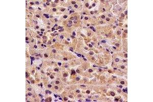 Immunohistochemical analysis of H6PD staining in rat kidney formalin fixed paraffin embedded tissue section. (Glucose-6-Phosphate Dehydrogenase Antikörper)
