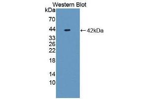 Western blot analysis of recombinant Rat NFkB. (NFkB Antikörper  (AA 352-439))