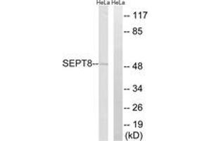 Western blot analysis of extracts from HeLa cells, using SEPT8 Antibody.