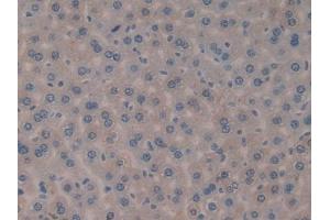 DAB staining on IHC-P; Samples: Mouse Liver Tissue (FIL1d Antikörper  (AA 1-156))