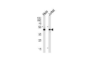 Western blot analysis of lysates from Hela,Jurkat cell line (from left to right),using PTGDR Antibody (ABIN486691 and ABIN1536072). (PTGDR Antikörper)