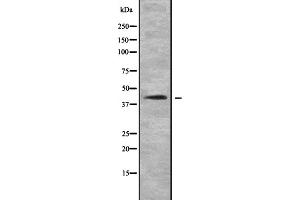 Western blot analysis of NDUFA10 expression in Human fetal heart lysate,The lane on the left is treated with the antigen-specific peptide. (NDUFA10 Antikörper  (C-Term))