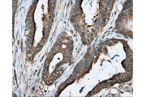 Immunohistochemical staining of paraffin-embedded liver tissue using anti-PRKAR2A mouse monoclonal antibody. (PRKAR2A Antikörper)