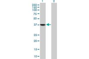 Western Blot analysis of BLVRA expression in transfected 293T cell line by BLVRA MaxPab polyclonal antibody. (Biliverdin Reductase Antikörper  (AA 1-296))
